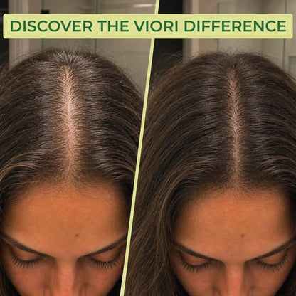 Tea Tree Shampoo Bar – Oily & Itchy Scalp | VIORI