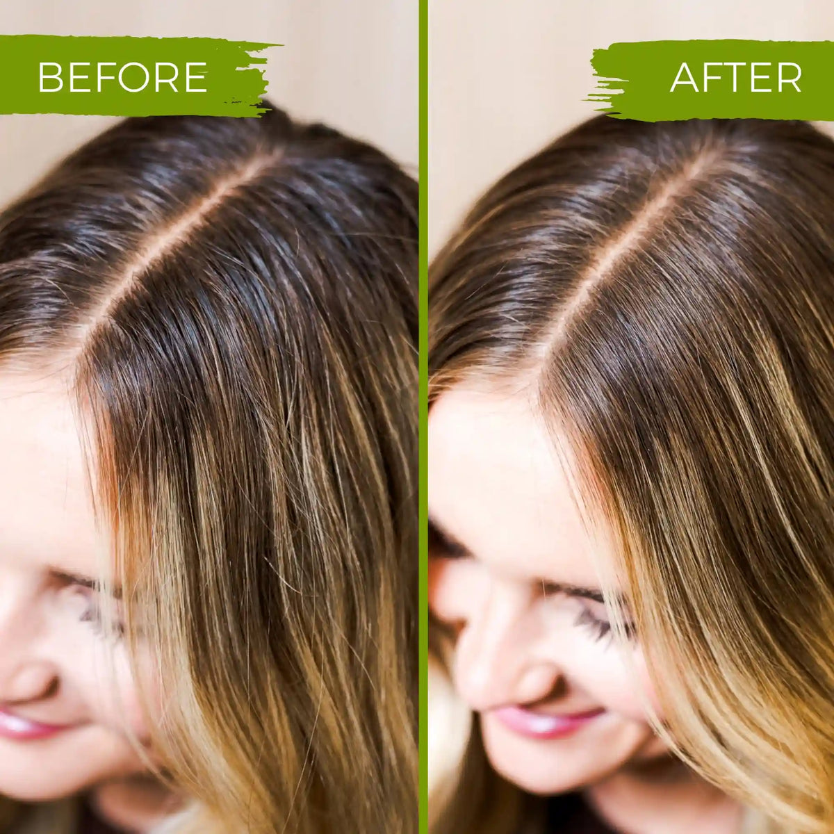 Tea Tree Shampoo Bar – Oily & Itchy Scalp | VIORI