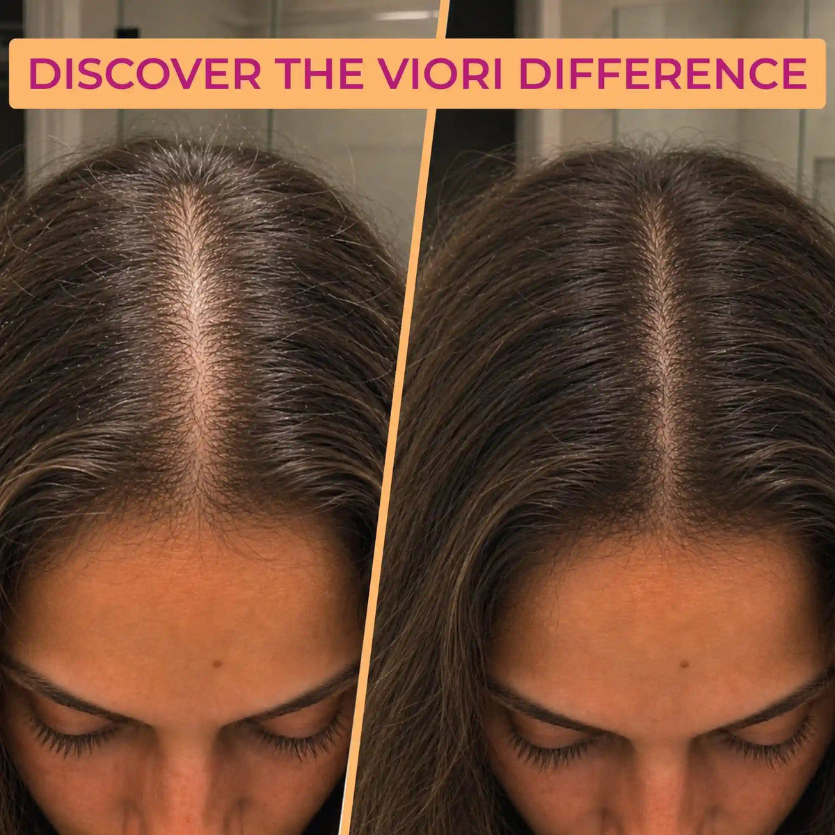 Castor Oil Conditioner Bar – Brittle & Dry Ends | VIORI