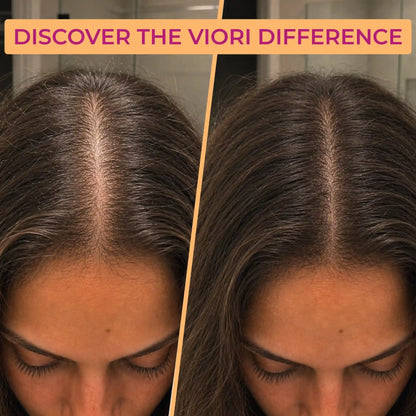Castor Oil Conditioner Bar – Brittle & Dry Ends | VIORI